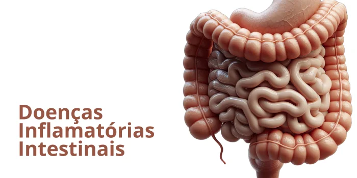 Doenças Inflamatórias Intestinais - Dra. Maria Júlia Colossi Gastroenterologista